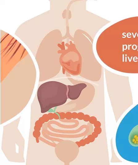 guide-pfic-children-video