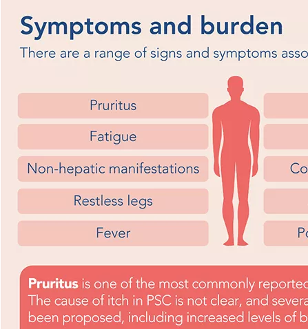 primary-sclerosing-cholangitis-infographic